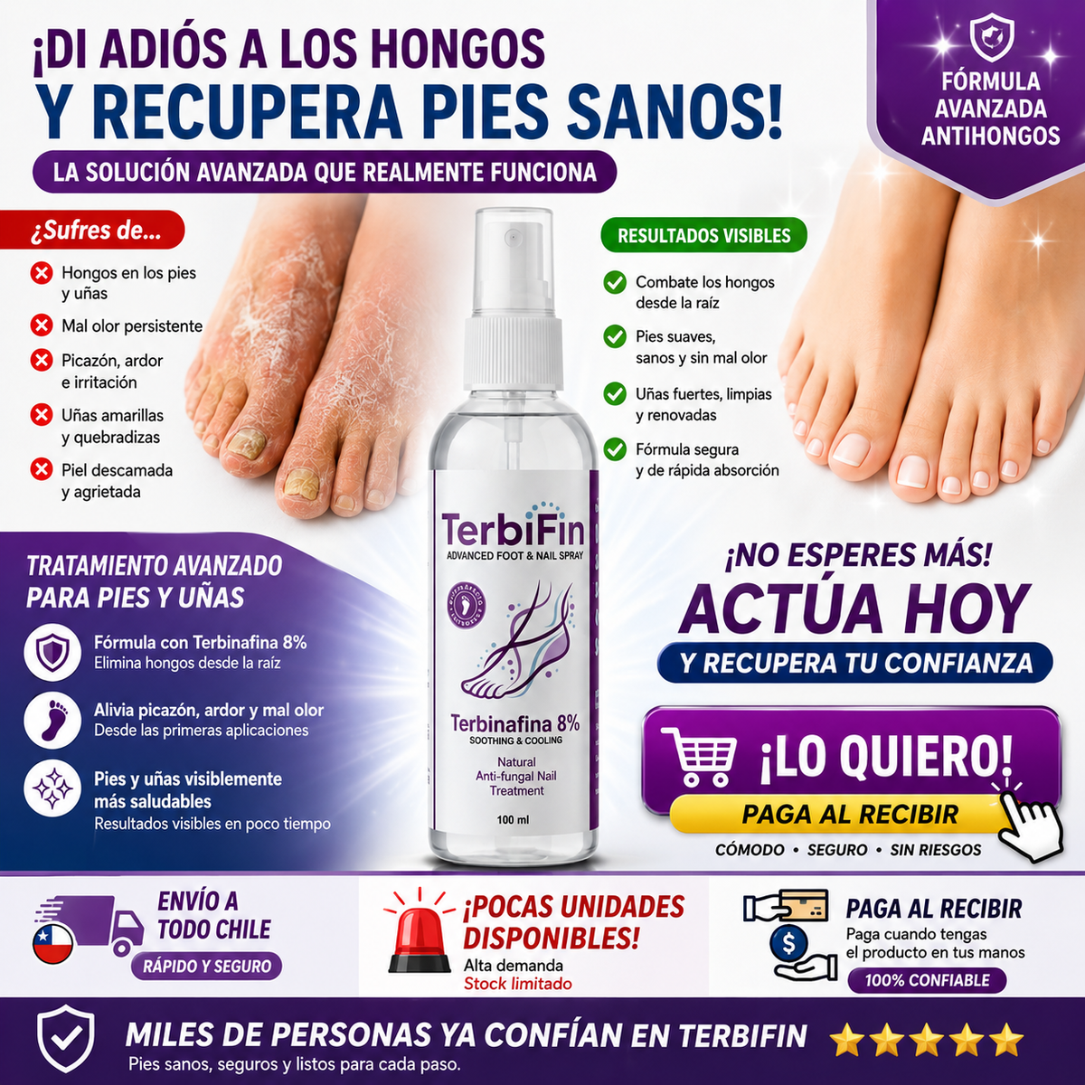 TerbiFin Spray 8% Anti-Hongos Pies Uñas