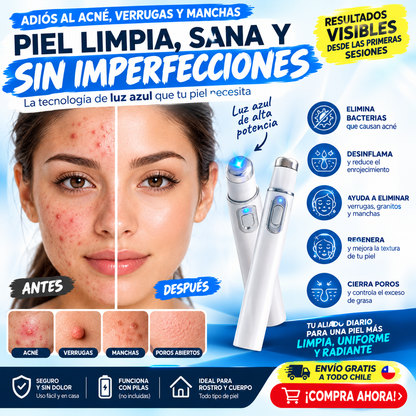PLUMA TERAPIA DE LUZ AZUL