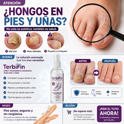 TerbiFin Spray 8% Anti-Hongos Pies Uñas