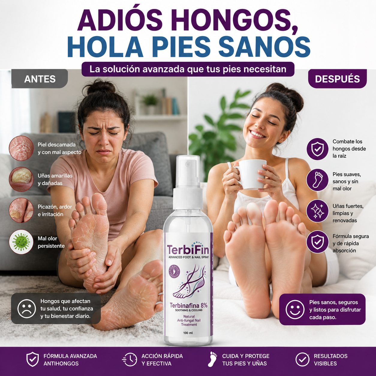 TerbiFin Spray 8% Anti-Hongos Pies Uñas