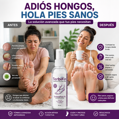 TerbiFin Spray 8% Anti-Hongos Pies Uñas